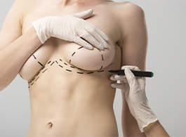 Mamoplastias pós-operatório