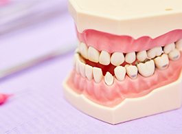 Oclusão dental
