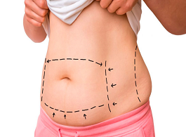 Obesidade e Cirurgia Bariátrica